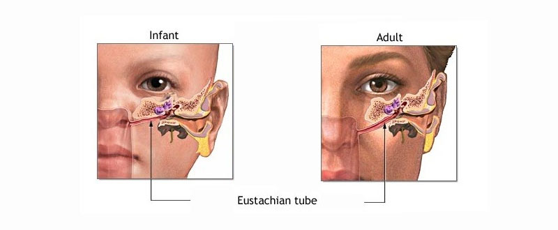 Tips For Treating Blocked Ears All About Hearing